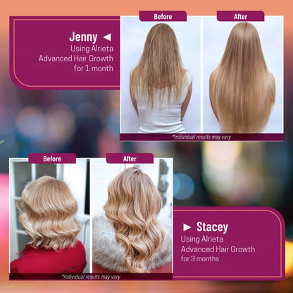 Advanced Hair Growth for Women